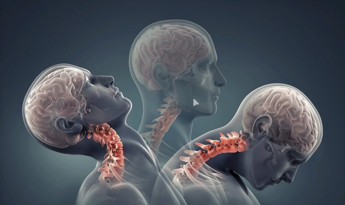 What To Do After a Concussion: A Guide for Active Adults